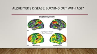 ALZHEIMER’S DISEASE: BURNING OUT WITH AGE?
74
 