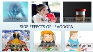 Dizziness Nausea Dark coloured urine
Unusual dreams Loss of apetite Abdominal cramps
SIDE EFFECTS OF LEVODOPA
 