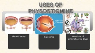 Bladder atony Glaucoma Overdose of
anticholinergic drugs
 