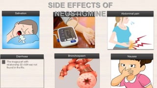 Salivation Hypotension Abdominal pain
Diarrhoea Bronchospasm Nausea
SIDE EFFECTS OF
NEOSTIGMINE
 