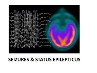 SEIZURES & STATUS EPILEPTICUS
 