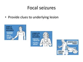 Focal seizures
• Provide clues to underlying lesion
 