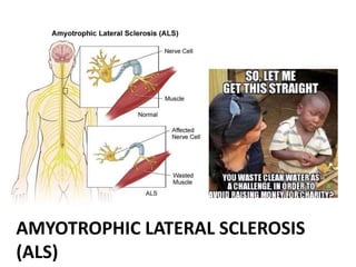 AMYOTROPHIC LATERAL SCLEROSIS
(ALS)
 