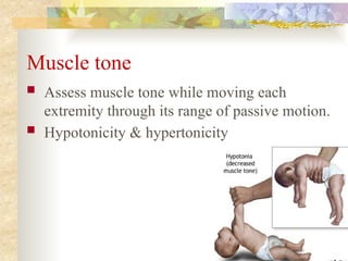 Muscle Hypertonicity Example neurological exam full assessment presentation | PPTX