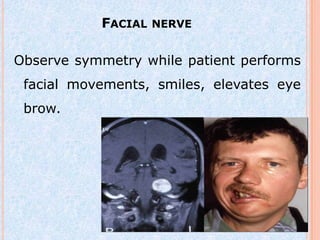 FACIAL NERVE

Observe symmetry while patient performs
 facial movements, smiles, elevates eye
 brow.
 