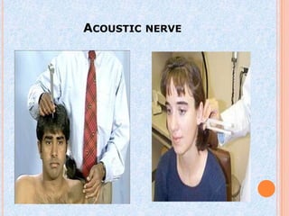 ACOUSTIC NERVE
 