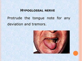 HYPOGLOSSAL NERVE

Protrude the tongue note for any
deviation and tremors.
 