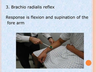3. Brachio radialis reflex

Response is flexion and supination of the
 fore arm
 