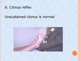 6. Clonus reflex

Unsustained clonus is normal
 