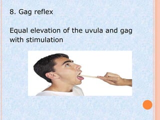 8. Gag reflex

Equal elevation of the uvula and gag
with stimulation
 