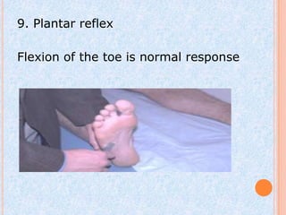 9. Plantar reflex

Flexion of the toe is normal response
 