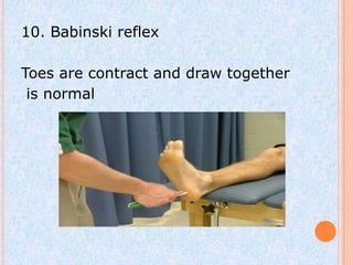 10. Babinski reflex

Toes are contract and draw together
 is normal
 