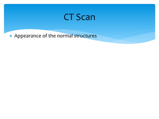  Appearance of the normal structures
CT Scan
 