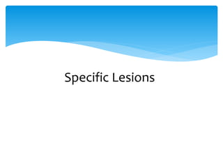 Specific Lesions
 