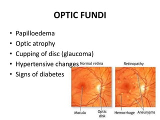 OPTIC FUNDI
• Papilloedema
• Optic atrophy
• Cupping of disc (glaucoma)
• Hypertensive changes
• Signs of diabetes
7
 