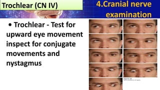• Trochlear - Test for
upward eye movement
inspect for conjugate
movements and
nystagmus
4.Cranial nerve
examination
Trochlear (CN IV)
 