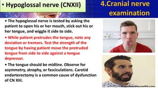 • The hypoglossal nerve is tested by asking the
patient to open his or her mouth, stick out his or
her tongue, and wiggle it side to side.
• While patient protrudes the tongue, note any
deviation or tremors. Test the strength of the
tongue by having patient move the protruded
tongue from side to side against a tongue
depressor.
• The tongue should be midline. Observe for
asymmetry, atrophy, or fasciculations. Carotid
endarterectomy is a common cause of dysfunction
of CN XIII.
4.Cranial nerve
examination
• Hypoglossal nerve (CNXII)
 