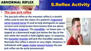 • The jaw jerk reflex
• The jaw jerk reflex or the masseter reflex is a stretch
reflex used to test the status of a patient's trigeminal
nerve (cranial nerve V) and to help distinguish an upper
cervical cord compression from lesions that are above
the foramen magnum. The mandible—or lower jaw—is
tapped at a downward angle just below the lips at the
chin while the mouth is held slightly open. In response,
the masseter muscles will jerk the mandible upwards.
Normally this reflex is absent or very slight. However, in
individuals with upper motor neuron lesions the jaw
jerk reflex can be quite pronounced.
8.Reflex Activity
ABNORMAL REFLEX
 