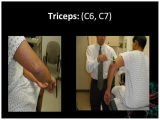 Triceps: (C6, C7)
 