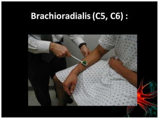 Brachioradialis (C5, C6) :
 
