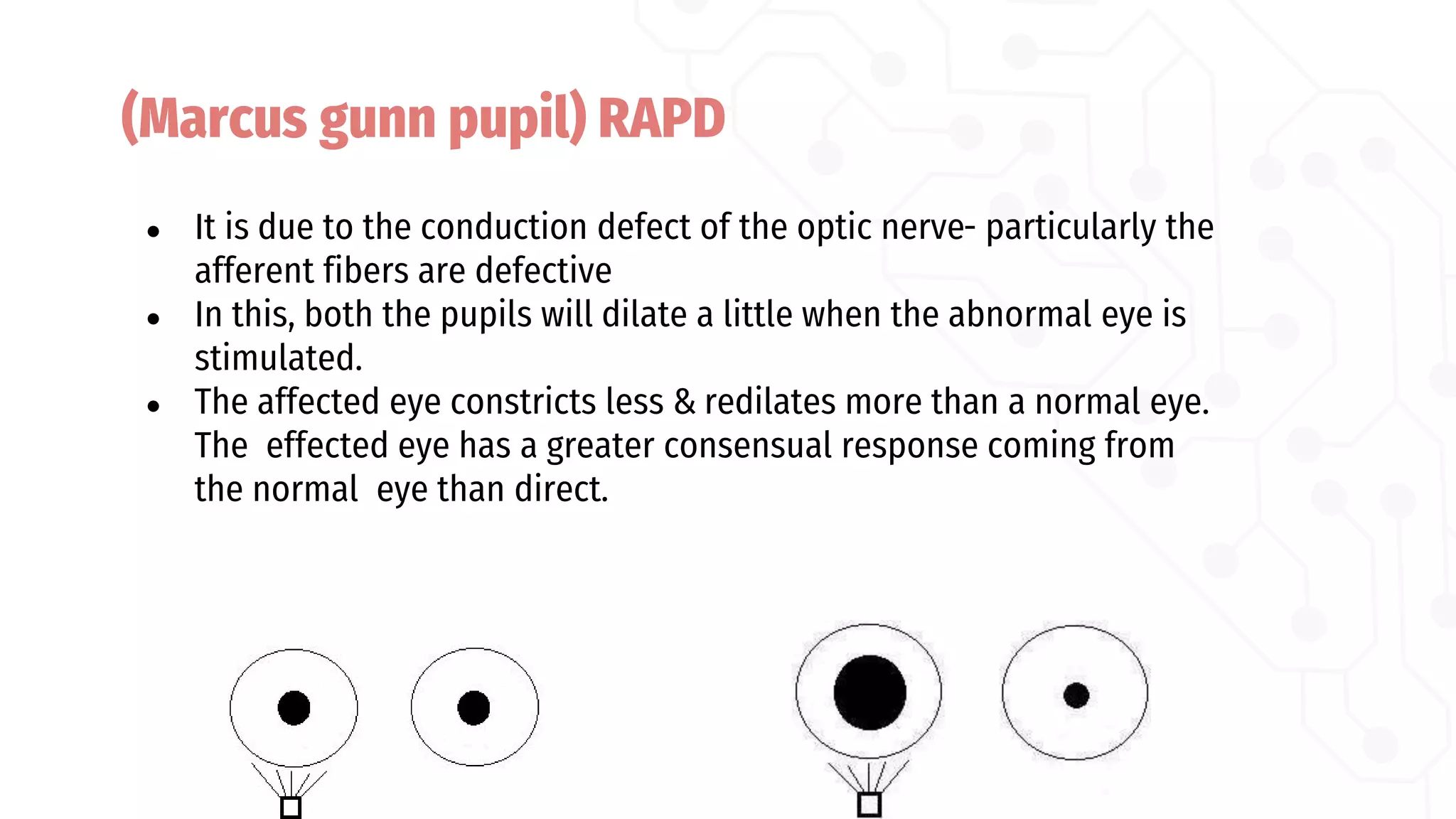Neurological eye disorder | PDF