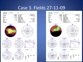 Case 3. Fields 27-11-09
 