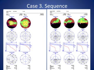 Case 3. Sequence
 
