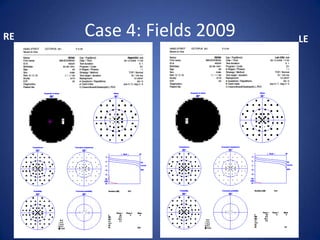 RE   Case 4: Fields 2009   LE
 