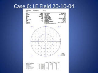 Case 6: LE Field 20-10-04
 