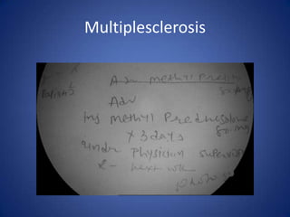 Multiplesclerosis
 