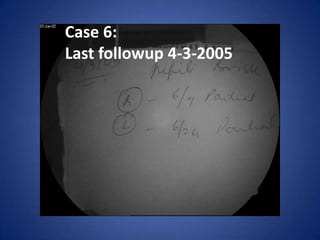Case 6:
Last followup 4-3-2005
 