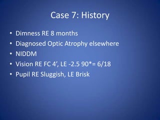 Case 7: History
•   Dimness RE 8 months
•   Diagnosed Optic Atrophy elsewhere
•   NIDDM
•   Vision RE FC 4’, LE -2.5 90*= 6/18
•   Pupil RE Sluggish, LE Brisk
 