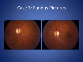 Case 7: Fundus Pictures
 