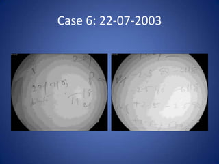 Case 6: 22-07-2003
 