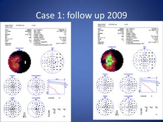 Case 1: follow up 2009
 