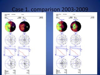 Case 1. comparison 2003-2009
 