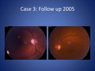 Case 3: Follow up 2005
 