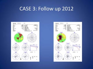 CASE 3: Follow up 2012
 