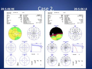 20-5-06 RE   Case 2.   20-5-06 LE
 