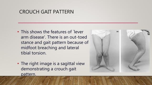 Neurological Gait Rehabilitation | PPTX
