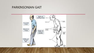 Neurological Gait Rehabilitation | PPTX