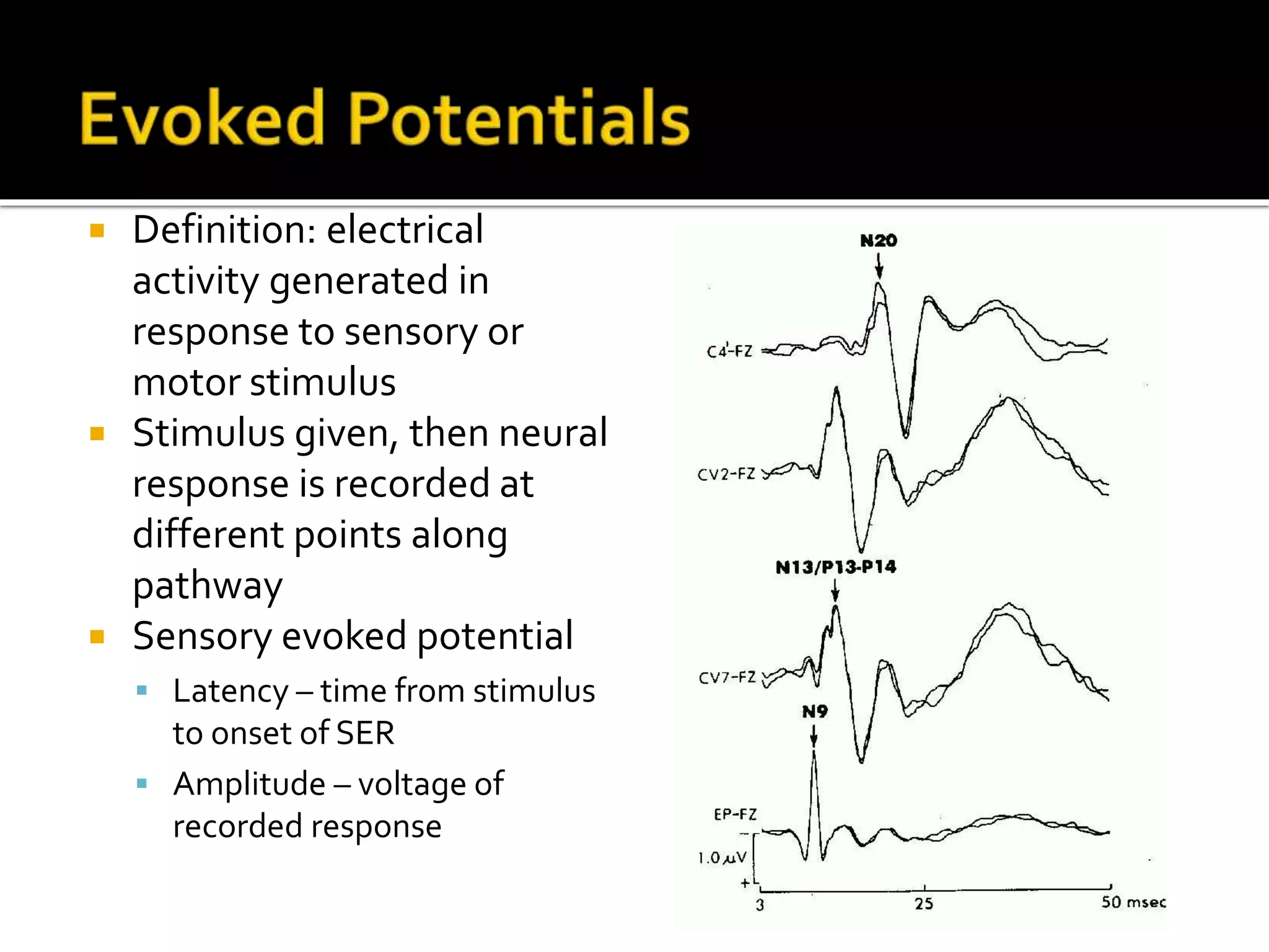  Definition: electrical
activity generated in
response to sensory or
motor stimulus
 Stimulus given, then neural
response is recorded at
different points along
pathway
 Sensory evoked potential
 Latency – time from stimulus
to onset of SER
 Amplitude – voltage of
recorded response
 