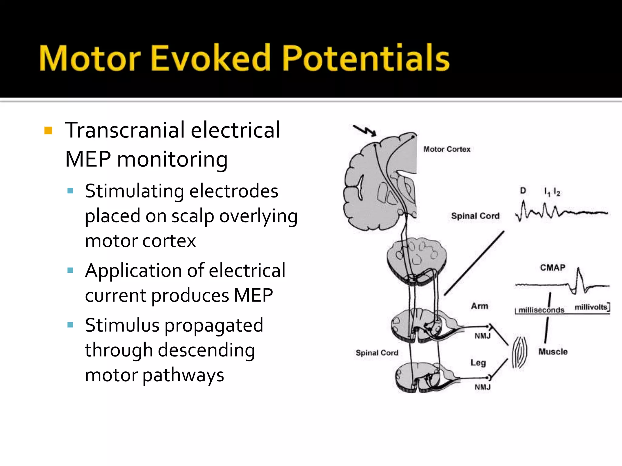  Transcranial electrical
MEP monitoring
 Stimulating electrodes
placed on scalp overlying
motor cortex
 Application of electrical
current produces MEP
 Stimulus propagated
through descending
motor pathways
 