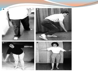 Neurological signs in medicine | PPTX