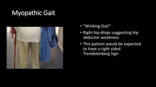 Myopathic Gait
• “Winking Gait”
• Right hip drops suggesting hip
abductor weakness
• This patient would be expected
to have a right sided
Trendelenberg Sign
 