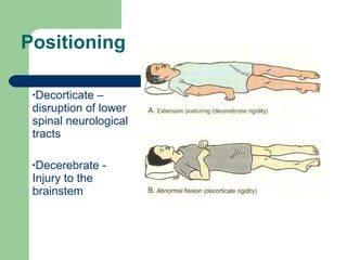 Positioning Decorticate – disruption of lower spinal neurological tracts Decerebrate -  Injury to the brainstem 