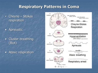 Atxic Respiratory Pattern Neurologic and Neurosurgical Emergencies for nursing students.pptx
