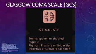 GLASGOW COMA SCALE (GCS)
Reference:
Royal College of Physicians and
Surgeons of Glasgow (2018). The
Glasgow structured app...