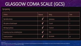 GLASGOW COMA SCALE (GCS)
Reference:
Royal College of Physicians and Surgeons of Glasgow (2018). The Glasgow structured app...