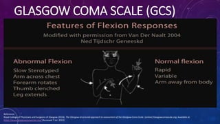 GLASGOW COMA SCALE (GCS)
Reference:
Royal College of Physicians and Surgeons of Glasgow (2018). The Glasgow structured app...